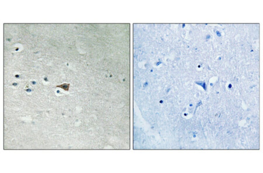 Immunohistochemistry - Anti-Arrestin 1 (phospho Ser412) Antibody (A0455) - Antibodies.com