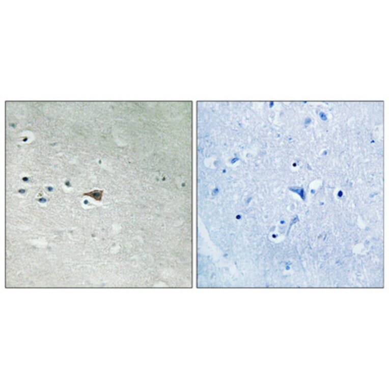 Immunohistochemistry - Anti-Arrestin 1 (phospho Ser412) Antibody (A0455) - Antibodies.com