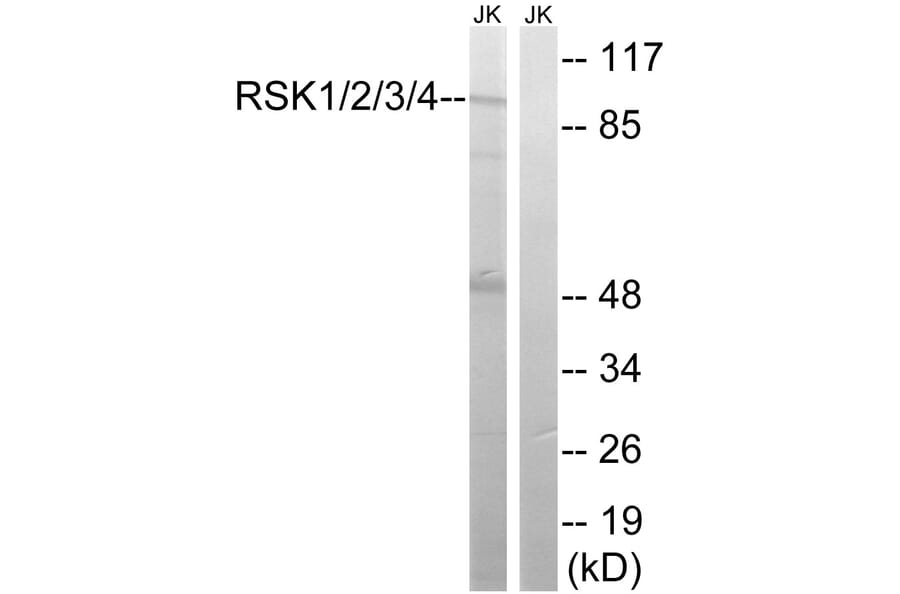 Western Blot - Anti-RSK1 + RSK2 + RSK3 + RSK4 Antibody (B8182) - Antibodies.com