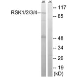 Western Blot - Anti-RSK1 + RSK2 + RSK3 + RSK4 Antibody (B8182) - Antibodies.com
