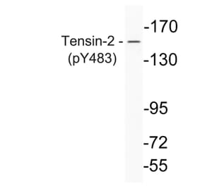 Western Blot - Anti-Tensin-2 (phospho Tyr483) Antibody (P12-1059) - Antibodies.com