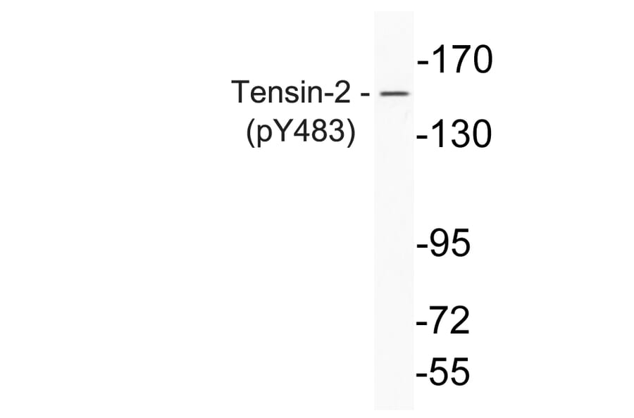 Western Blot - Anti-Tensin-2 (phospho Tyr483) Antibody (P12-1059) - Antibodies.com