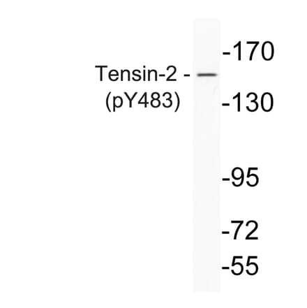 Western Blot - Anti-Tensin-2 (phospho Tyr483) Antibody (P12-1059) - Antibodies.com