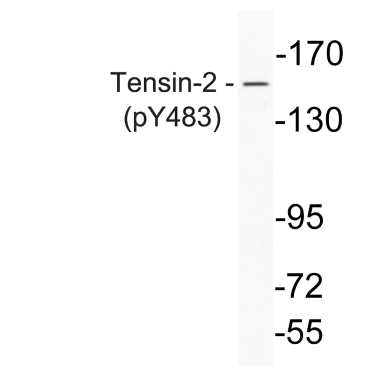Western Blot - Anti-Tensin-2 (phospho Tyr483) Antibody (P12-1059) - Antibodies.com