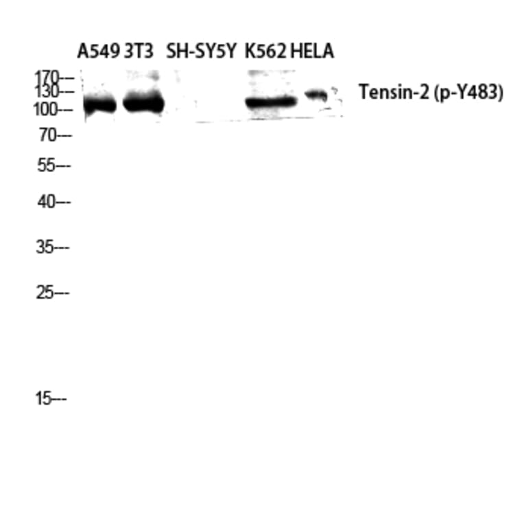 Western Blot - Anti-Tensin-2 (phospho Tyr483) Antibody (P12-1059) - Antibodies.com