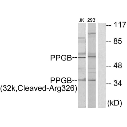 Western Blot - Anti-PPGB (32k,cleaved Arg326) Antibody (L0313) - Antibodies.com