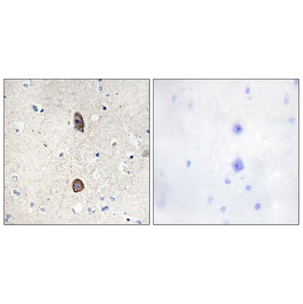 Immunohistochemistry - Anti-IGFBP-3 (phospho Ser183) Antibody (A1052) - Antibodies.com