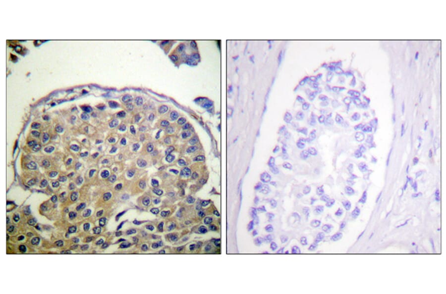 Immunohistochemistry - Anti-CD227 (phospho Tyr1243) Antibody (A0844) - Antibodies.com