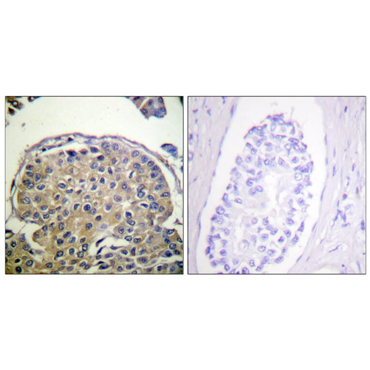 Immunohistochemistry - Anti-CD227 (phospho Tyr1243) Antibody (A0844) - Antibodies.com