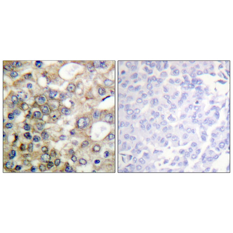 Immunohistochemistry - Anti-CD227 (phospho Tyr1229) Antibody (A1193) - Antibodies.com