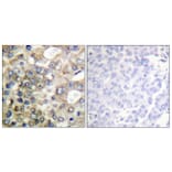 Immunohistochemistry - Anti-CD227 (phospho Tyr1229) Antibody (A1193) - Antibodies.com