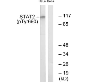 Western Blot - Anti-STAT2 (phospho Tyr690) Antibody (A0089) - Antibodies.com