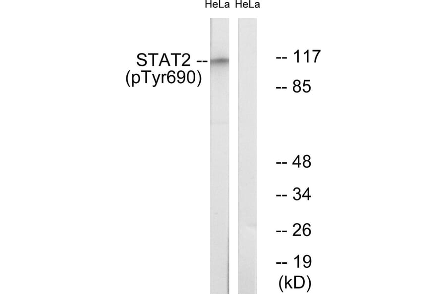 Western Blot - Anti-STAT2 (phospho Tyr690) Antibody (A0089) - Antibodies.com