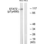 Western Blot - Anti-STAT2 (phospho Tyr690) Antibody (A0089) - Antibodies.com