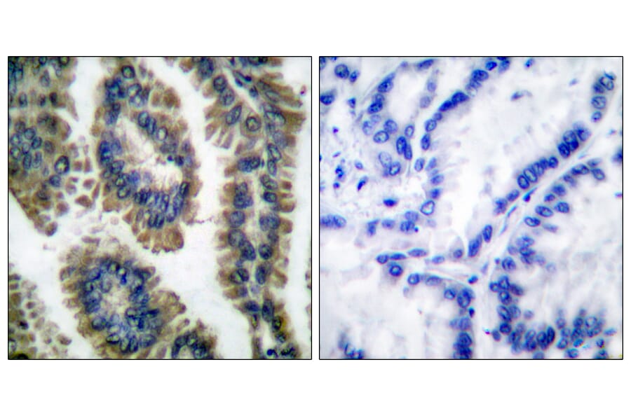 Immunohistochemistry - Anti-STAT2 (phospho Tyr690) Antibody (A0089) - Antibodies.com