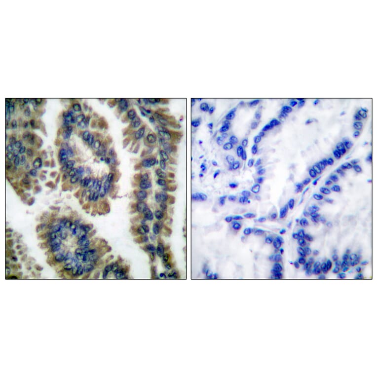 Immunohistochemistry - Anti-STAT2 (phospho Tyr690) Antibody (A0089) - Antibodies.com