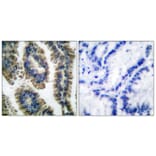 Immunohistochemistry - Anti-STAT2 (phospho Tyr690) Antibody (A0089) - Antibodies.com