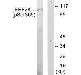 Western Blot - Anti-eEF2K (phospho Ser366) Antibody (A0071) - Antibodies.com