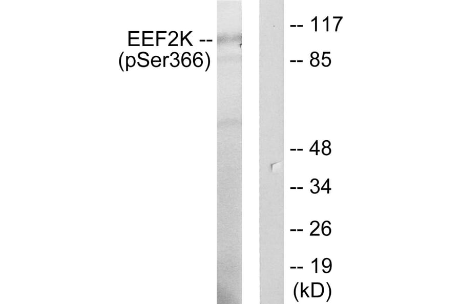 Western Blot - Anti-eEF2K (phospho Ser366) Antibody (A0071) - Antibodies.com