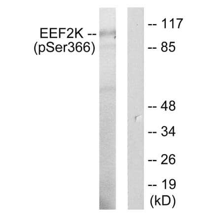 Western Blot - Anti-eEF2K (phospho Ser366) Antibody (A0071) - Antibodies.com