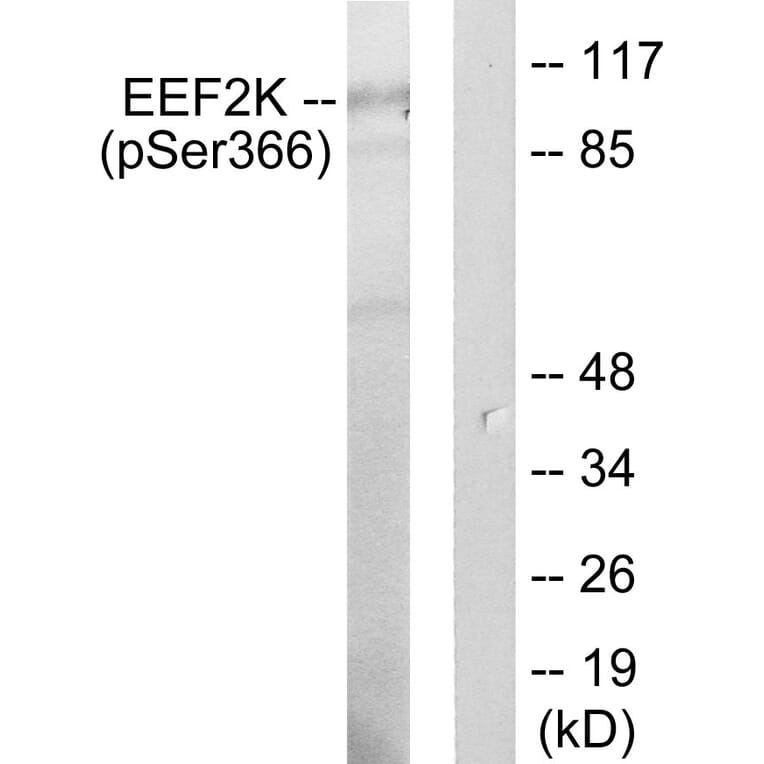 Western Blot - Anti-eEF2K (phospho Ser366) Antibody (A0071) - Antibodies.com