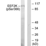 Western Blot - Anti-eEF2K (phospho Ser366) Antibody (A0071) - Antibodies.com