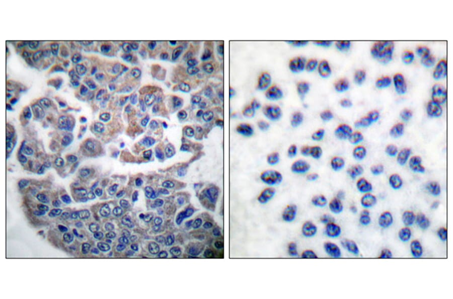 Immunohistochemistry - Anti-eEF2K (phospho Ser366) Antibody (A0071) - Antibodies.com