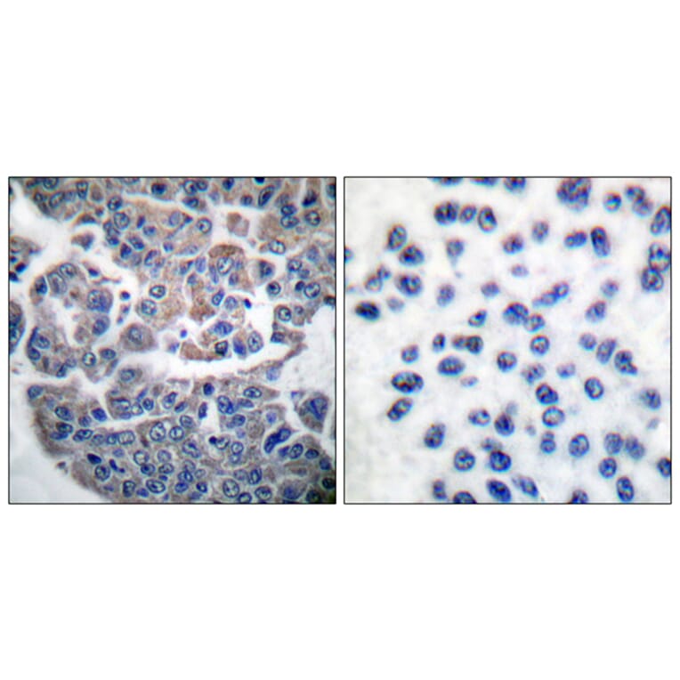 Immunohistochemistry - Anti-eEF2K (phospho Ser366) Antibody (A0071) - Antibodies.com