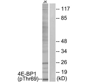 Western Blot - Anti-4E-BP1 (phospho Thr69) Antibody (A0402) - Antibodies.com