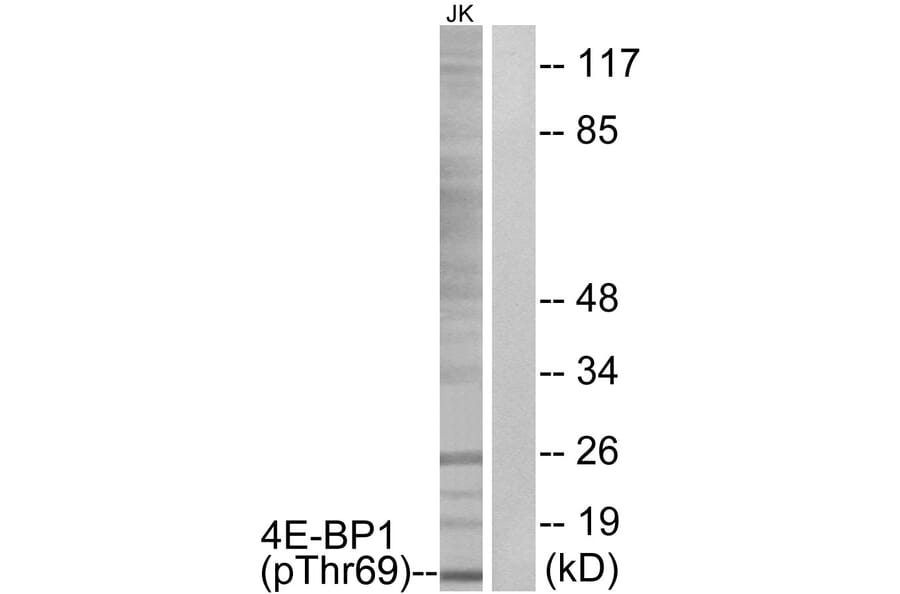 Western Blot - Anti-4E-BP1 (phospho Thr69) Antibody (A0402) - Antibodies.com