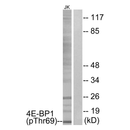 Western Blot - Anti-4E-BP1 (phospho Thr69) Antibody (A0402) - Antibodies.com