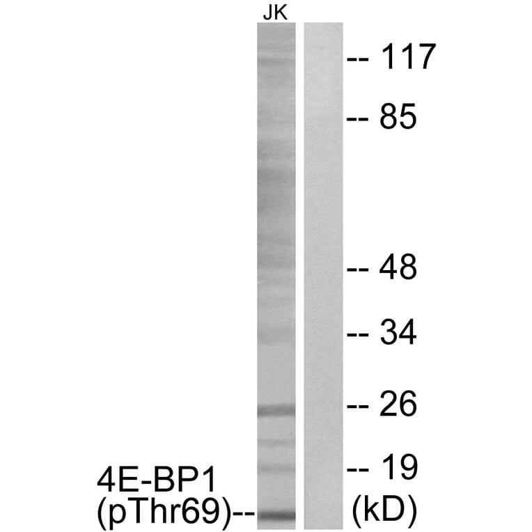 Western Blot - Anti-4E-BP1 (phospho Thr69) Antibody (A0402) - Antibodies.com