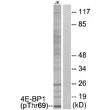 Western Blot - Anti-4E-BP1 (phospho Thr69) Antibody (A0402) - Antibodies.com