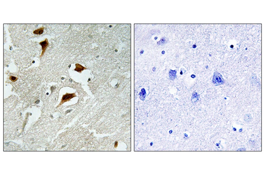 Immunohistochemistry - Anti-4E-BP1 (phospho Thr69) Antibody (A0402) - Antibodies.com