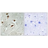 Immunohistochemistry - Anti-4E-BP1 (phospho Thr69) Antibody (A0402) - Antibodies.com