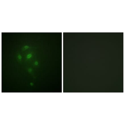 Immunofluorescence - Anti-MSK1 (phospho Thr581) Antibody (A0686) - Antibodies.com