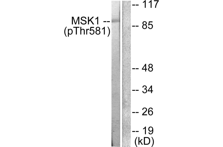 Western Blot - Anti-MSK1 (phospho Thr581) Antibody (A0686) - Antibodies.com