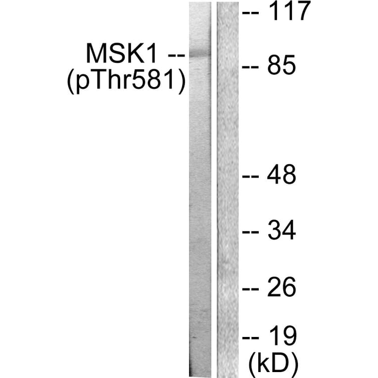 Western Blot - Anti-MSK1 (phospho Thr581) Antibody (A0686) - Antibodies.com