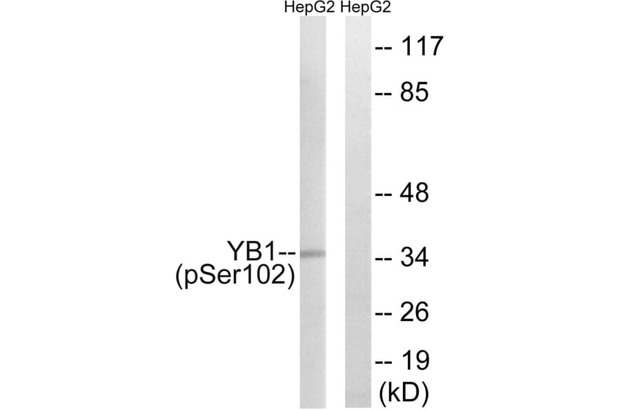 Western Blot - Anti-YB1 (phospho Ser102) Antibody (A8481) - Antibodies.com