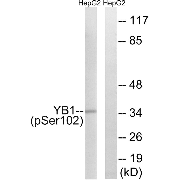 Western Blot - Anti-YB1 (phospho Ser102) Antibody (A8481) - Antibodies.com