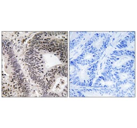 Immunohistochemistry - Anti-WWOX (phospho Tyr33) Antibody (A8276) - Antibodies.com