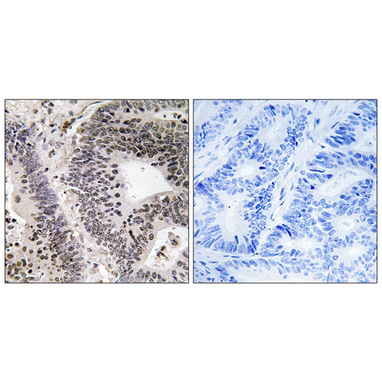 Immunohistochemistry - Anti-WWOX (phospho Tyr33) Antibody (A8276) - Antibodies.com
