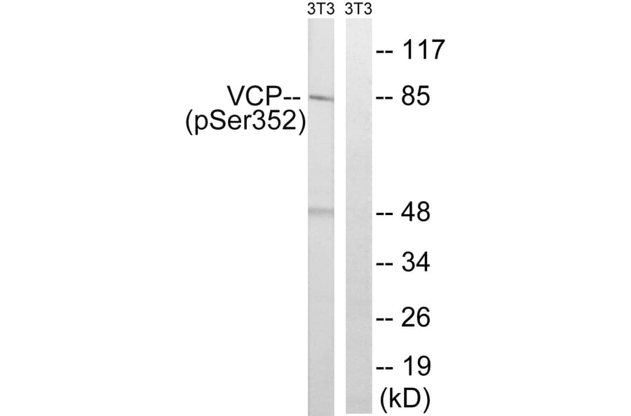 Western Blot - Anti-VCP (phospho Ser352) Antibody (A8449) - Antibodies.com