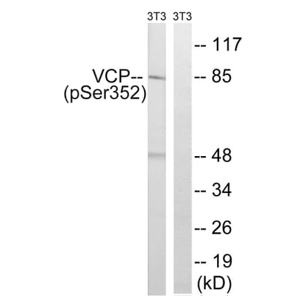 Western Blot - Anti-VCP (phospho Ser352) Antibody (A8449) - Antibodies.com