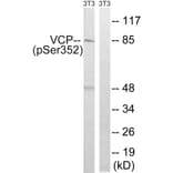 Western Blot - Anti-VCP (phospho Ser352) Antibody (A8449) - Antibodies.com