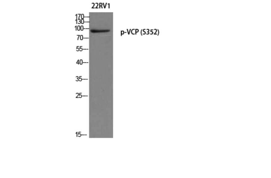 Western Blot - Anti-VCP (phospho Ser352) Antibody (A8449) - Antibodies.com