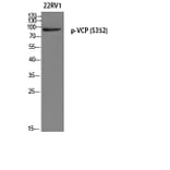 Western Blot - Anti-VCP (phospho Ser352) Antibody (A8449) - Antibodies.com