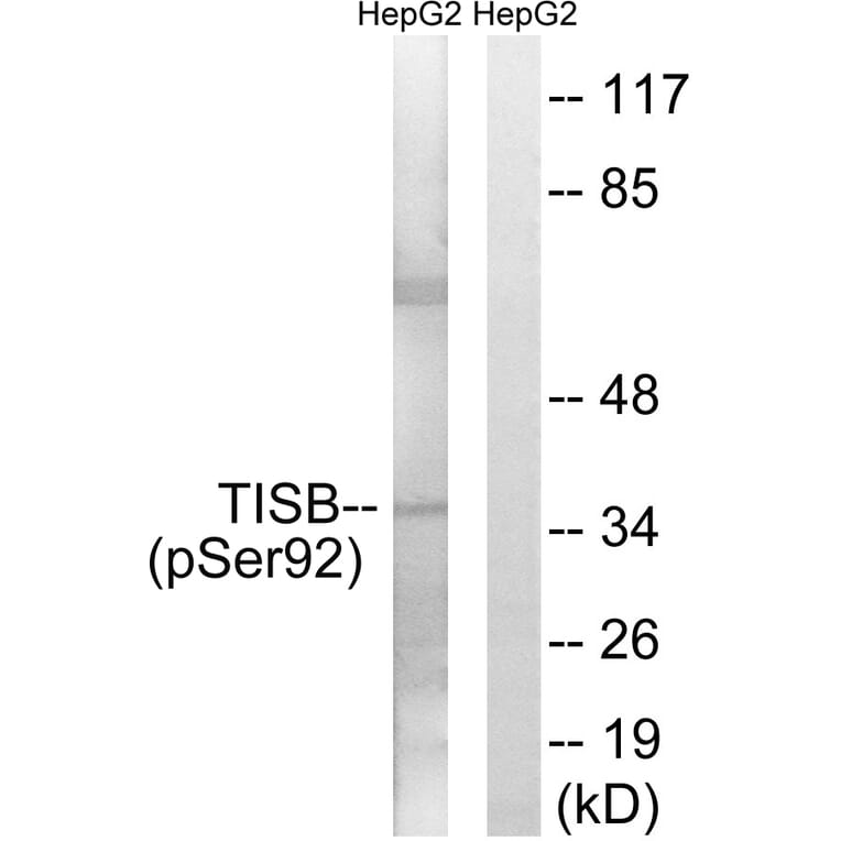 Western Blot - Anti-TISB (phospho Ser92) Antibody (A1184) - Antibodies.com