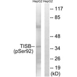 Western Blot - Anti-TISB (phospho Ser92) Antibody (A1184) - Antibodies.com