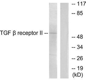 Western Blot - Anti-TGF beta Receptor II Antibody (C0338) - Antibodies.com
